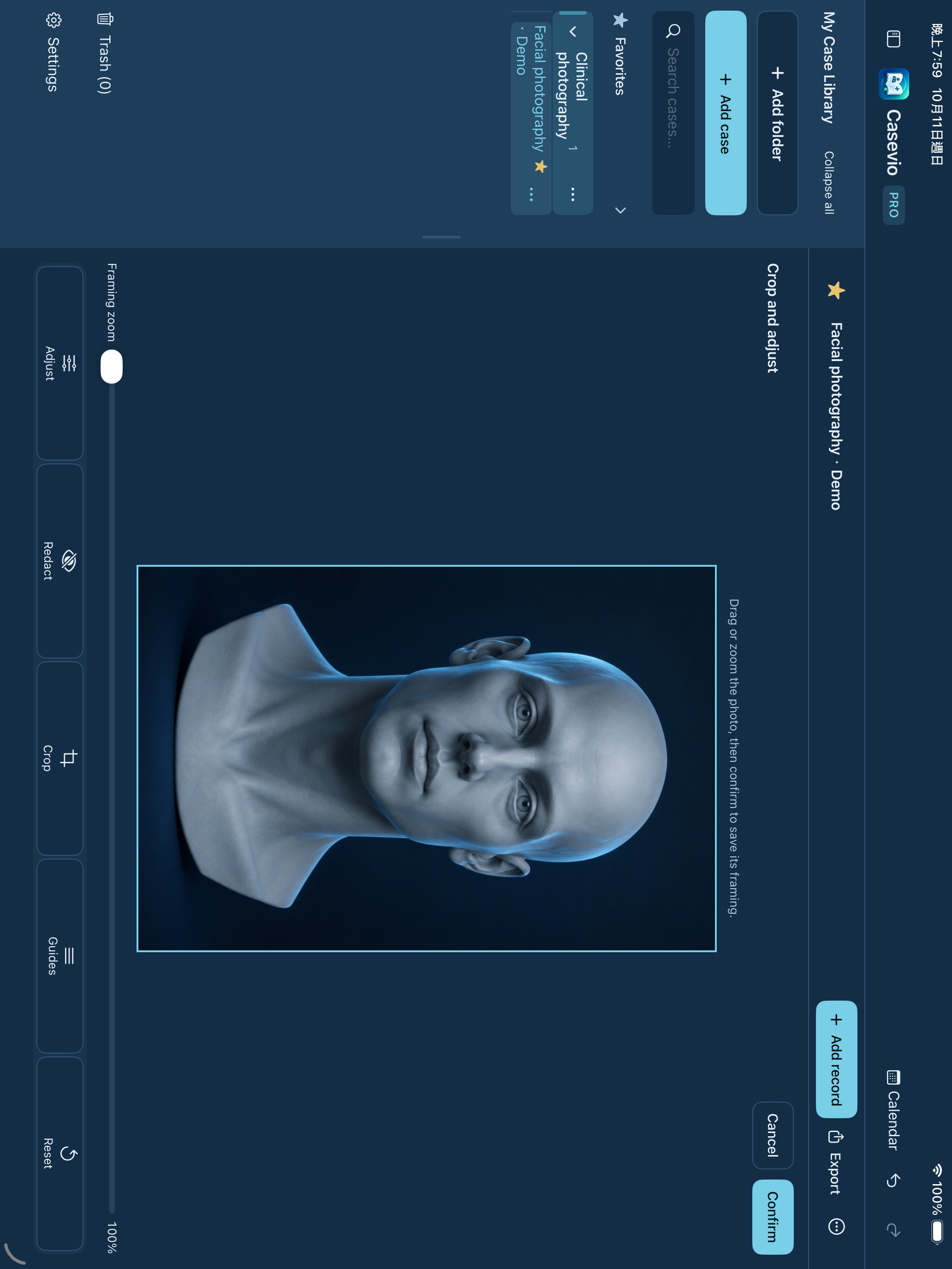 Casevio photo editor with the actual framing zoom, adjust, redact, crop, guides and reset controls.